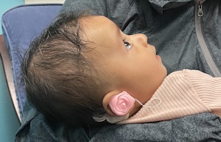 Infant receiving a hearing test